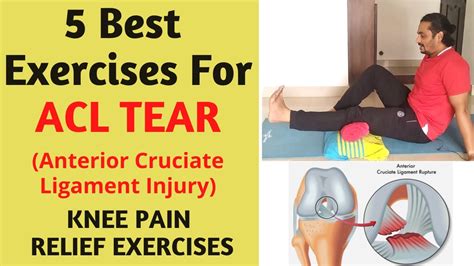 at home test for acl tear|high grade acl tear treatment.